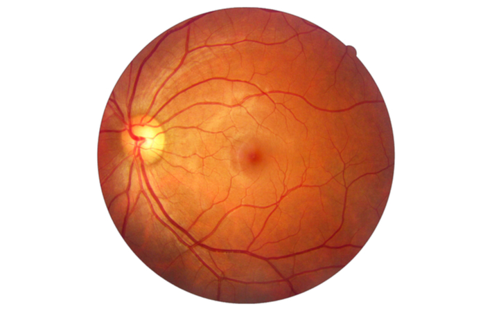 Retinal Imaging: How it Works & Why It's Important ...