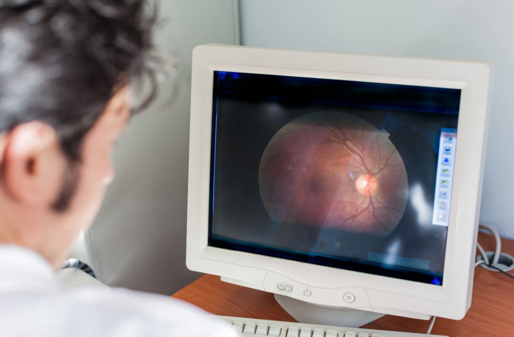 A close-up of a male ophthalmologist looking at a retina scan in a computer monitor.